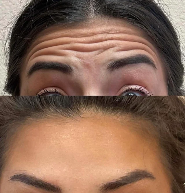 Forehead comparison photographs shared by Payne & King