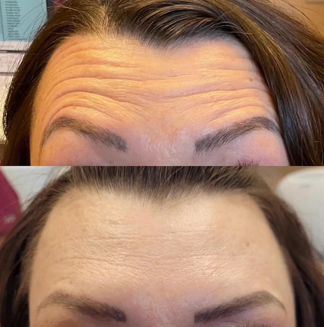 Forehead comparison photographs shared by Payne & King