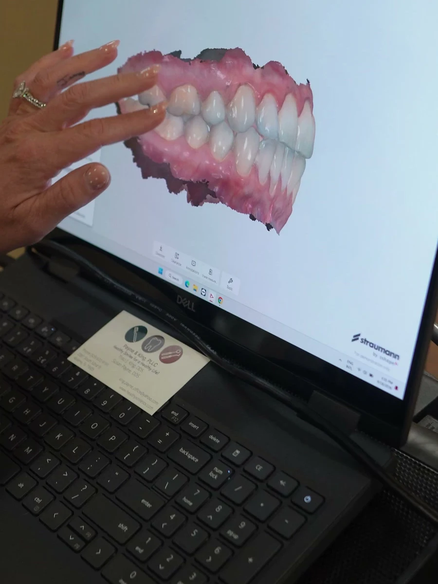 A digital view of teeth being reviewed at Payne & King