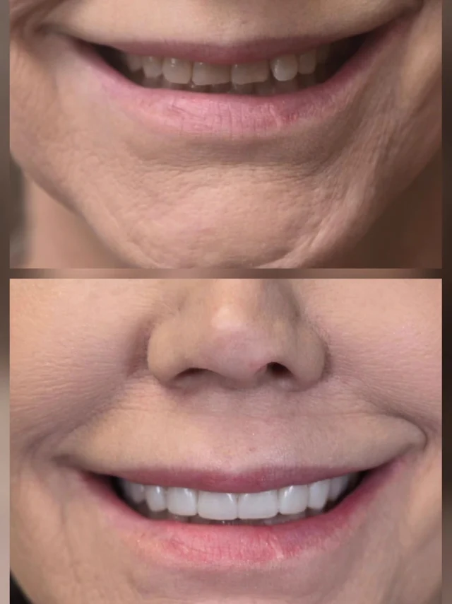 Smile comparison photographs shared by Payne & King