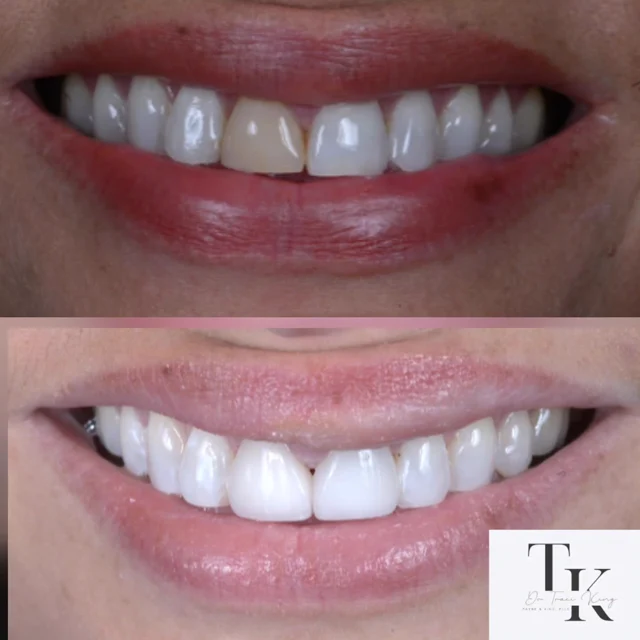 Smile comparison photographs shared by Payne & King