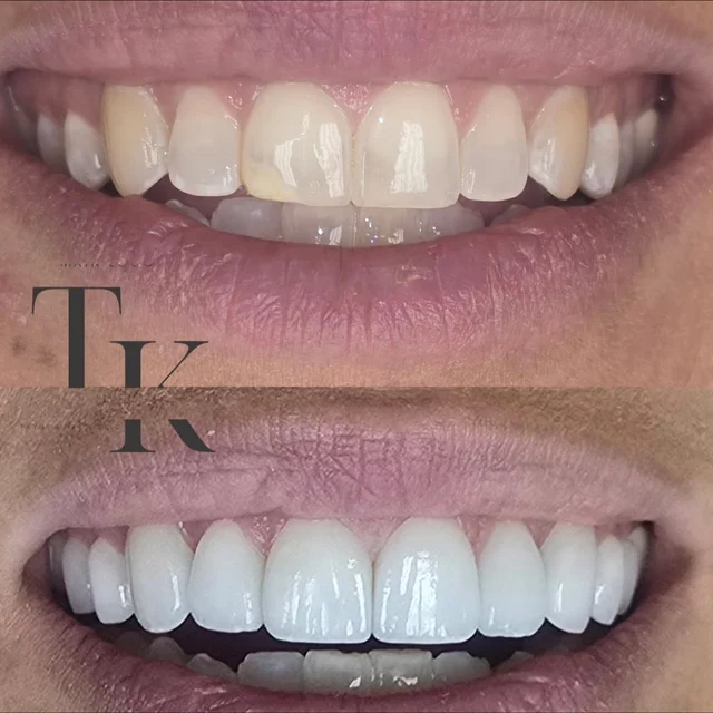 Smile comparison photographs shared by Payne & King